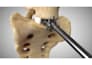 create 3d surgical animation, medical visualization and anatomy videos